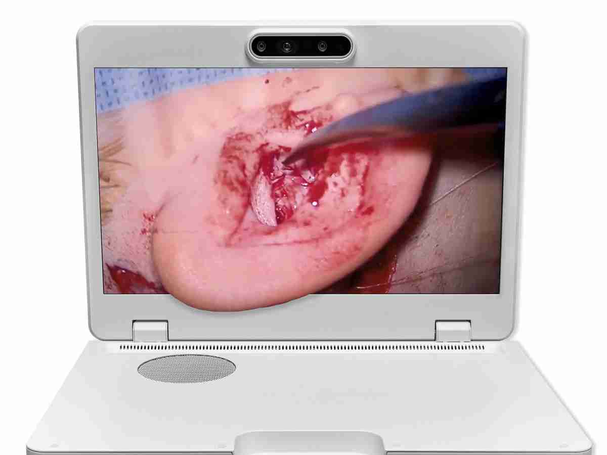 达擎之＂Heads-up 3D显微手术显示系统＂，，，整合4K裸眼3D显示及眼球追踪系统，，，，具备快速追踪人眼移动位置功能，，，减轻医师长时间维持固定姿势的负担，，让医师能有更宽广清晰的3D立体视野及更舒适的姿势来执行手术。。。。